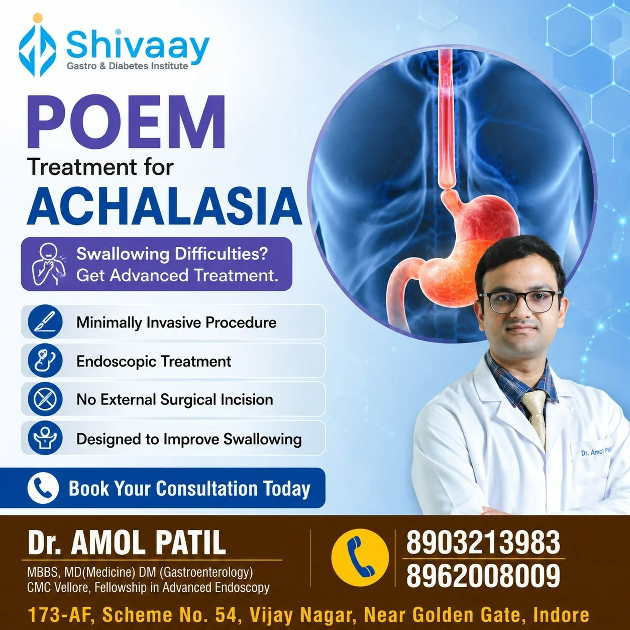 POEM Treatment for Achalasia in Indore